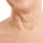 Understanding Neck Aging and How to Prevent It